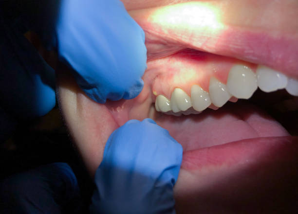 Best Emergency Cosmetic Dentistry in Chandler, IN